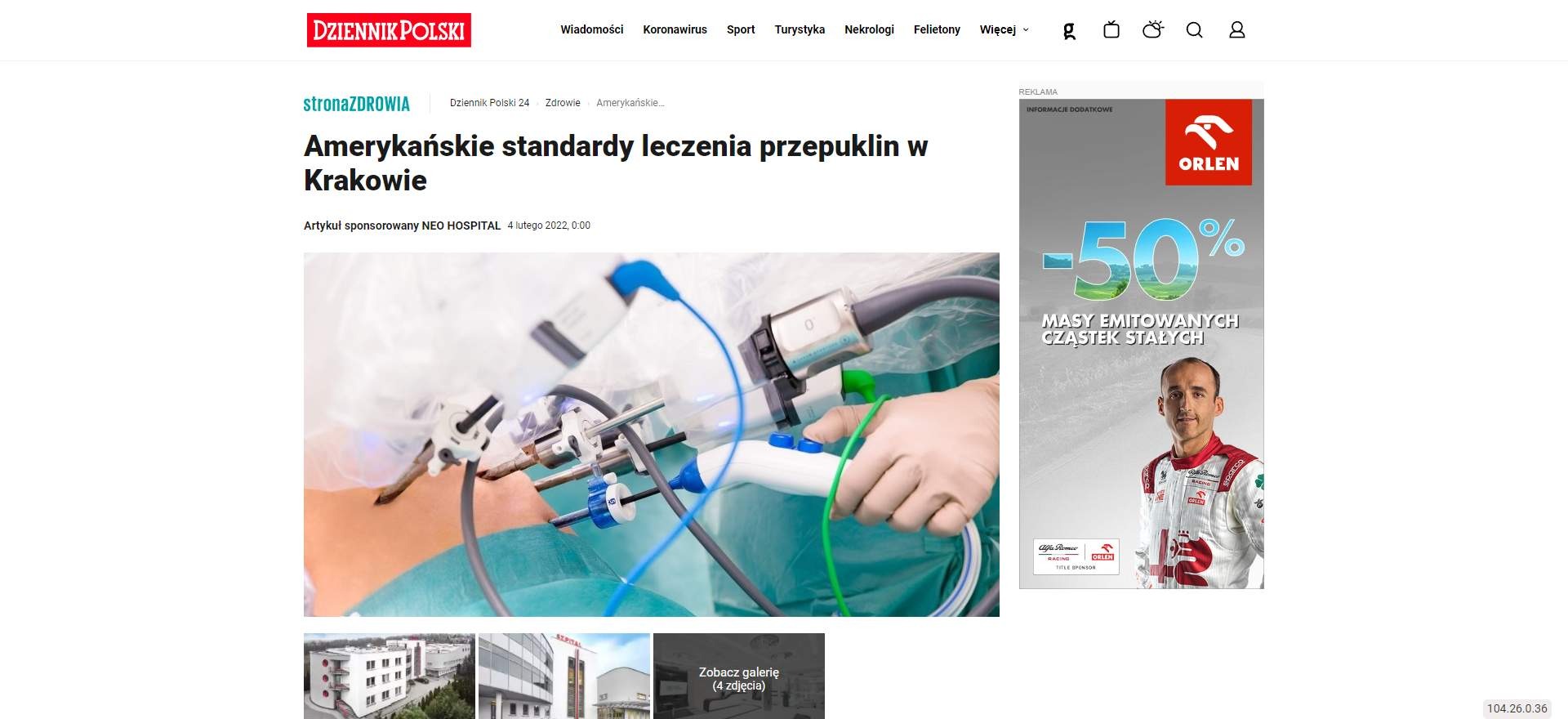 amerykanskie standardy leczenia przepuklin w krakowie