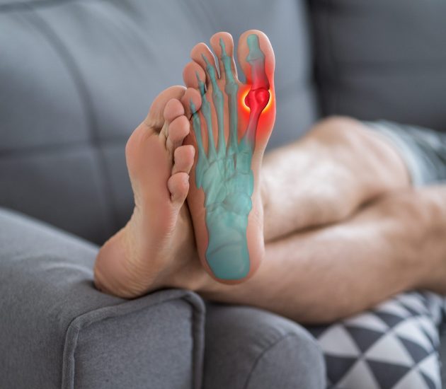 Joint diseases, hallux valgus, plantar fasciitis, man's leg hurts, pain in the foot, health problems concept