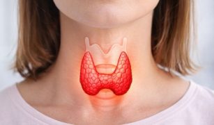 Nadczynność tarczycy. Kiedy organizm działa na zbyt wysokich obrotach