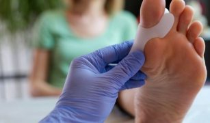 Operacja haluksów bez długiej rekonwalescencji_ Metoda MICA w leczeniu palucha koślawego