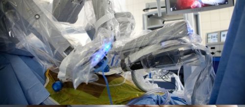 Robotyczna operacja raka prostaty. Precyzja i realne bezpieczeństwo pacjenta