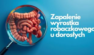Zapalenie wyrostka robaczkowego u dorosłych