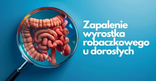 Zapalenie wyrostka robaczkowego u dorosłych