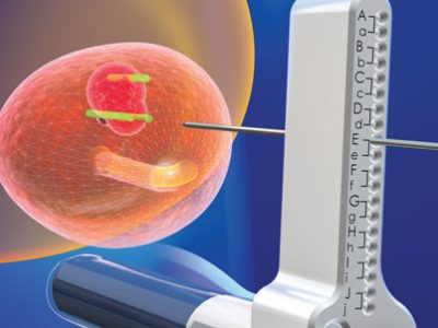 biopsja-fuzyjna-prostaty-gruczolu-krokowego-w-krakowskim-szpitalu-na-klinach-1
