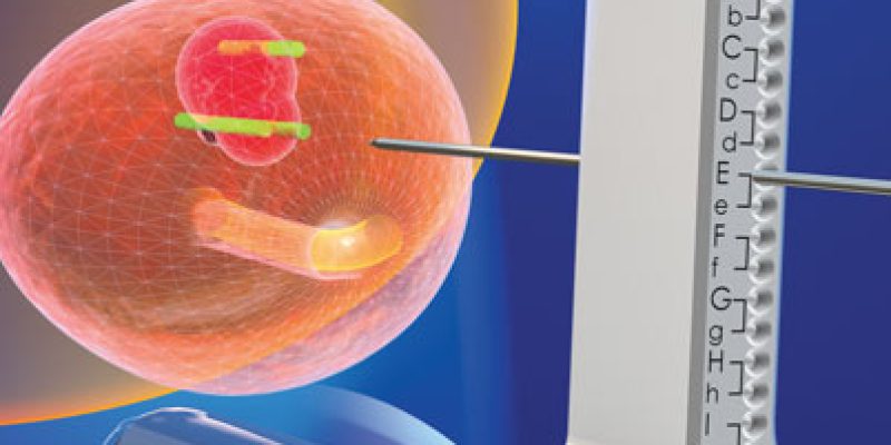 biopsja-fuzyjna-prostaty-gruczolu-krokowego-w-krakowskim-szpitalu-na-klinach-1