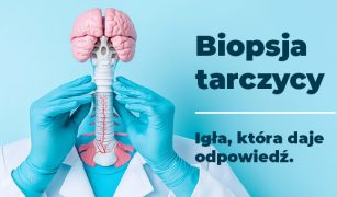 biopsja-tarczycy-1