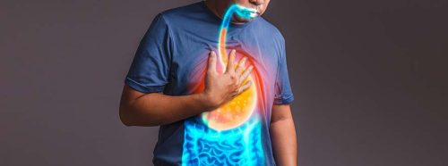 choroba-refluksowa-przelyku-objawy-diagnostyka-leczenie-1