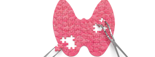 co-musisz-wiedziec-o-nowotworach-tarczycy-endokrynolog-wyjasnia-2