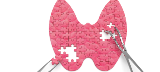 co-musisz-wiedziec-o-nowotworach-tarczycy-endokrynolog-wyjasnia-2