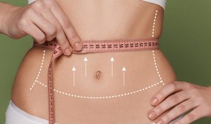 co-powinienes-wiedziec-o-liposukcji