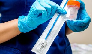 cytologia-plynna-mniej-bledow-wiecej-szans-nowa-era-profilaktyki