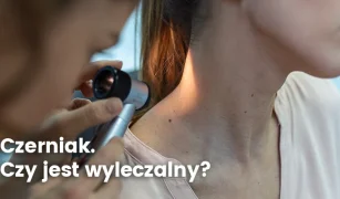 czerniak-czy-jest-wylaczalny