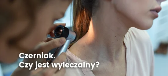 czerniak-czy-jest-wylaczalny