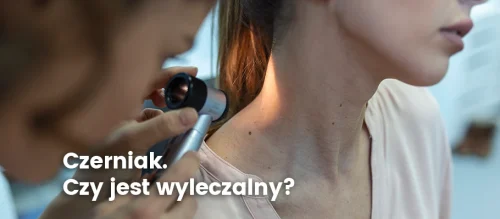 czerniak-czy-jest-wylaczalny