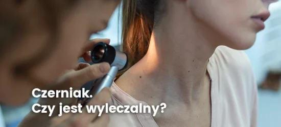 czerniak-czy-jest-wylaczalny