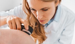 czerniak-jak-wyglada-i-czym-rozni-sie-od-pieprzyka-1