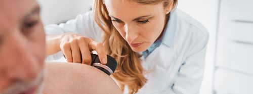 czerniak-jak-wyglada-i-czym-rozni-sie-od-pieprzyka-1