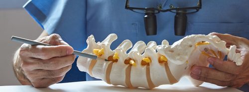 czy-cement-moze-ratowac-kregoslup-sekret-nowoczesnej-wertebroplastyki-1