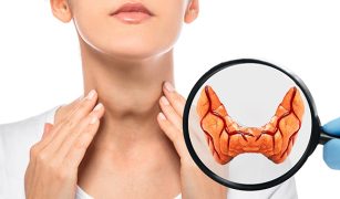 czym-jest-choroba-gravesa-basedowa-i-jak-ja-rozpoznac-1