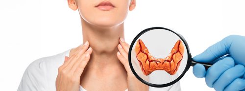 czym-jest-choroba-gravesa-basedowa-i-jak-ja-rozpoznac-1