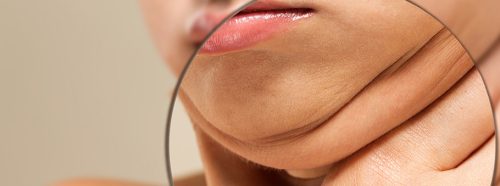 drugi-podbrodek-sprawdz-czy-plastyka-podbrodka-to-rozwiazanie-dla-ciebie-1