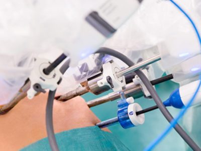 grupa-neo-hospital-wspiera-wdrozenie-robotyki-chirurgicznej-w-mazowieckim-szpitalu-specjalistycznym-1