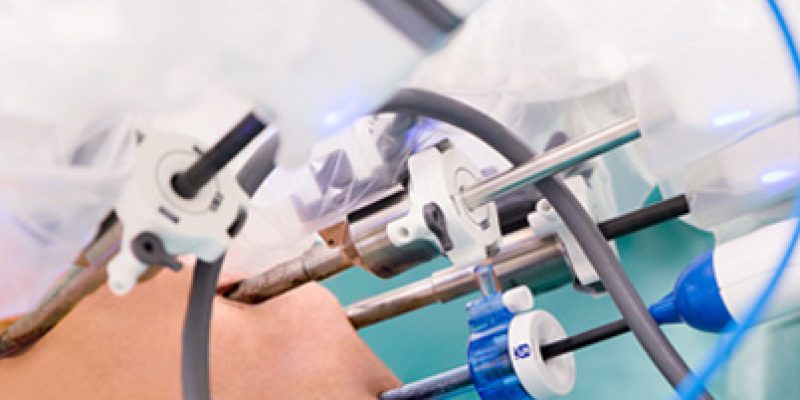 grupa-neo-hospital-wspiera-wdrozenie-robotyki-chirurgicznej-w-mazowieckim-szpitalu-specjalistycznym-1