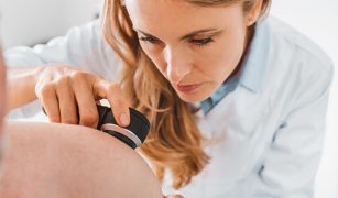 jak-wygladaja-znamiona-rakowe-1