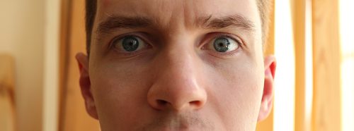 konchoplastyka-operacyjna-korekcja-malzowin-nosowych-1