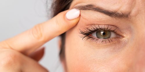 korekta-i-plastyka-powiek-czyli-co-warto-wiedziec-o-blefaroplastyce-1