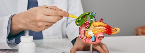 laparoskopowe-usuniecie-pecherzyka-zolciowego-cholecystektomia-1