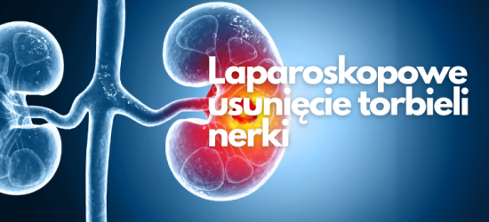 laparoskopowe-usuniecie-torbieli-nerki-2