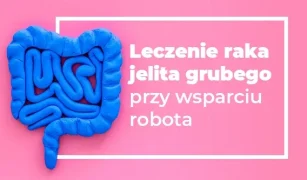 leczenie-raka-jelita-grubego