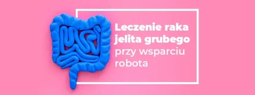 leczenie-raka-jelita-grubego