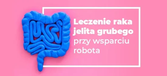 leczenie-raka-jelita-grubego