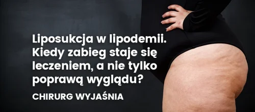 liposukcja-w-lipodemii