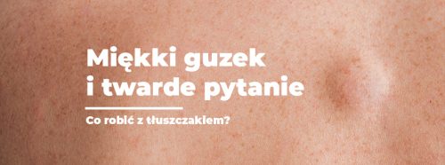 miekki-guzek-i-twarde-pytanie-co-robic-z-tluszczakiem-1