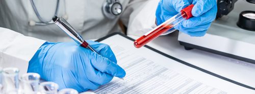 morfologia-krwi-jak-rozszyfrowac-wyniki-i-co-moga-oznaczac-1