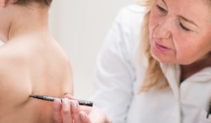 najczestsze-wady-postawy-u-dzieci-1