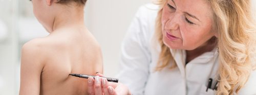 najczestsze-wady-postawy-u-dzieci-1