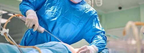 nie-schudniesz-na-stole-operacyjnym-prawda-o-liposukcji-2