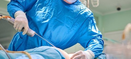 nie-schudniesz-na-stole-operacyjnym-prawda-o-liposukcji-2