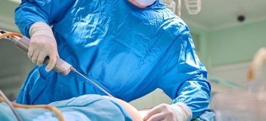 nie-schudniesz-na-stole-operacyjnym-prawda-o-liposukcji-2