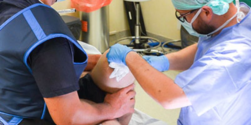 nowatorski-zabieg-protezowania-dla-pacjentow-po-amputacjach-w-szpitalu-na-klinach-w-krakowie