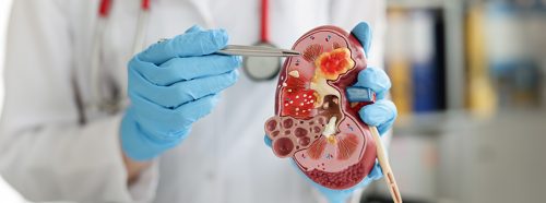 nowoczesne-technologie-w-onkologii-rola-robotyki-chirurgicznej-w-leczeniu-raka-nerki-1-kopia