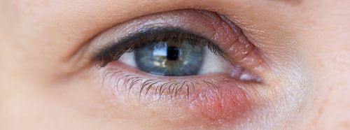 nuzyca-niewidzialny-pasazer-naszej-skory-1