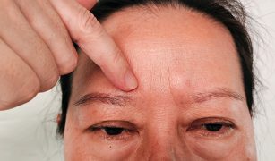 obrzek-sluzowaty-co-to-za-choroba-i-jak-mozna-ja-leczyc-1-1