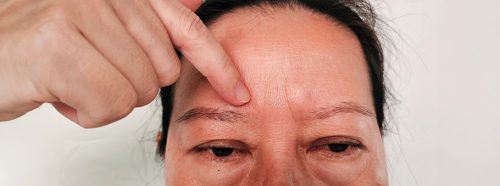 obrzek-sluzowaty-co-to-za-choroba-i-jak-mozna-ja-leczyc-1-1