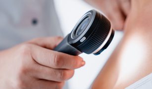 od-skory-po-pluca-rak-plaskonablonkowy-1