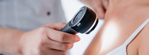 od-skory-po-pluca-rak-plaskonablonkowy-1